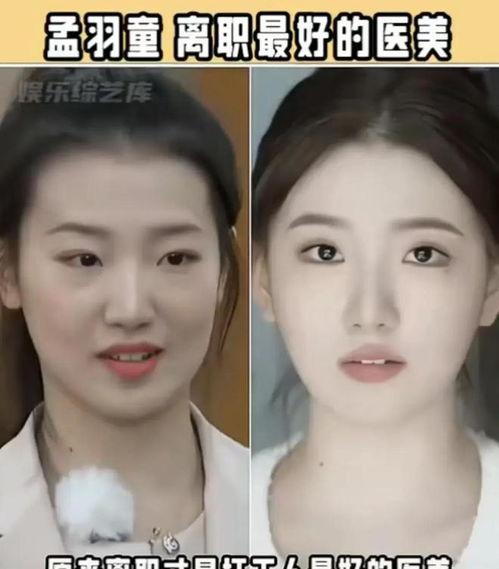 整容的视频,从素颜到蜕变