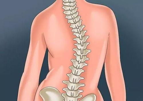 脊柱侧弯视频,成因、症状及矫正方法一览
