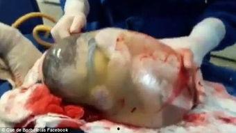 羊水破了要生了视频,真实分娩视频揭秘
