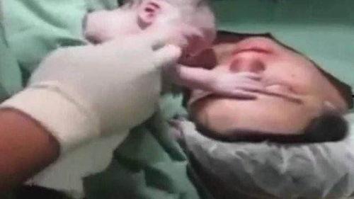 生孩子视频难产,见证生命诞生的震撼瞬间